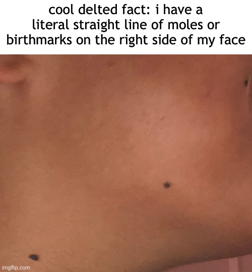 one of my driends pointed it out so i just did something | cool delted fact: i have a literal straight line of moles or birthmarks on the right side of my face | made w/ Imgflip meme maker