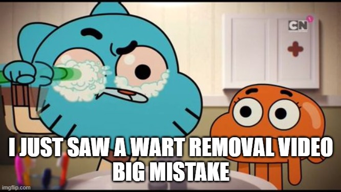 . | I JUST SAW A WART REMOVAL VIDEO
BIG MISTAKE | image tagged in gumball washing his eye | made w/ Imgflip meme maker