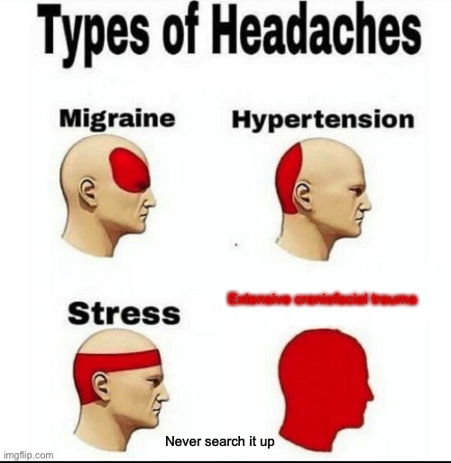 Types of Headaches meme | Extensive craniofacial trauma; Never search it up | image tagged in types of headaches meme | made w/ Imgflip meme maker