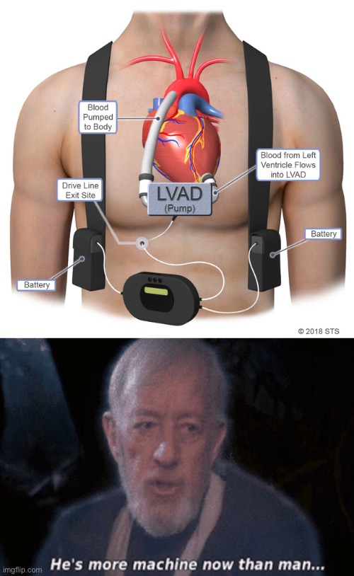 LVAD life | image tagged in he's more machine now than man,lvad,heart,lil pump,dying | made w/ Imgflip meme maker
