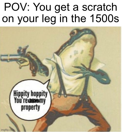 I refuse to upload more than once every few weeks | POV: You get a scratch on your leg in the 1500s; LEG’S | image tagged in hippity hoppity you're now my property | made w/ Imgflip meme maker
