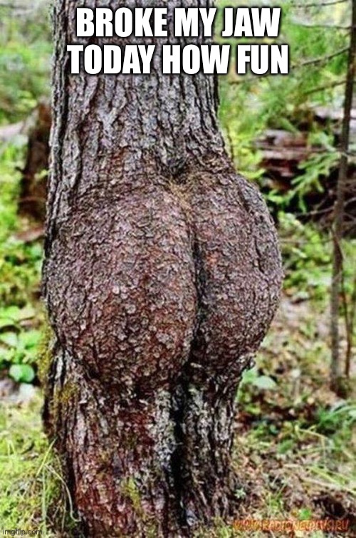 Also I think imma just use this image as an announcement temp or smthn idk | BROKE MY JAW TODAY HOW FUN | image tagged in sexy tree | made w/ Imgflip meme maker
