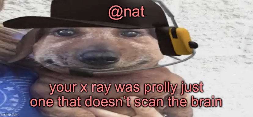 chucklenuts | @nat; your x ray was prolly just one that doesn’t scan the brain | image tagged in chucklenuts | made w/ Imgflip meme maker