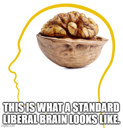 THIS IS WHAT A STANDARD LIBERAL BRAIN LOOKS LIKE. | made w/ Imgflip meme maker