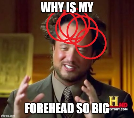 self burn | WHY IS MY; FOREHEAD SO BIG | image tagged in memes,ancient aliens,self burn,oof,forehead,big | made w/ Imgflip meme maker