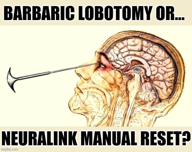 BARBARIC LOBOTOMY OR... NEURALINK MANUAL RESET? | image tagged in neuralink,elo musk,lobotomy | made w/ Imgflip meme maker