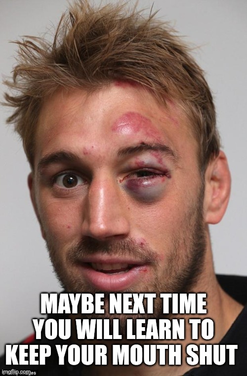 black eye | MAYBE NEXT TIME YOU WILL LEARN TO KEEP YOUR MOUTH SHUT | image tagged in black eye | made w/ Imgflip meme maker