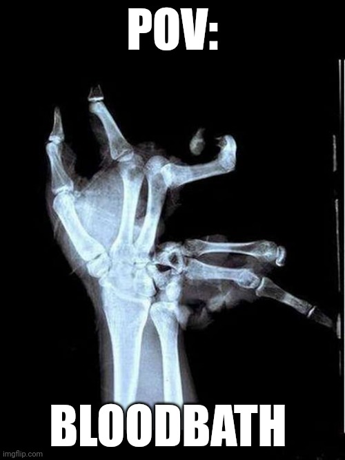 Broken Hand | POV:; BLOODBATH | image tagged in broken hand,geometry dash | made w/ Imgflip meme maker