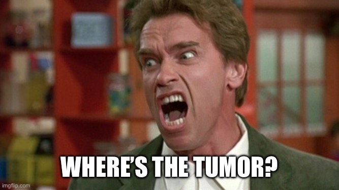 Tumor | WHERE’S THE TUMOR? | image tagged in arnold schwarzenegger screaming kindergarten cop | made w/ Imgflip meme maker