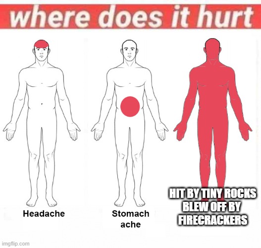 Where does it hurt | HIT BY TINY ROCKS
BLEW OFF BY 
FIRECRACKERS | image tagged in where does it hurt | made w/ Imgflip meme maker