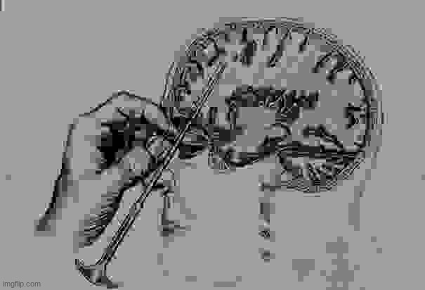 Lobotomy  | image tagged in lobotomy | made w/ Imgflip meme maker