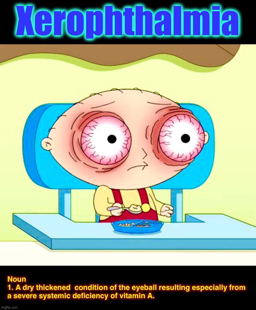 Word of the Day “X” | Xerophthalmia; Noun
1. A dry thickened  condition of the eyeball resulting especially from a severe systemic deficiency of vitamin A. | image tagged in stewie,word of the day,memes,family guy,eyes,medical | made w/ Imgflip meme maker