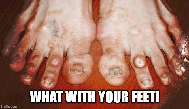 Ugly Feet | WHAT WITH YOUR FEET! | image tagged in ugly feet | made w/ Imgflip meme maker