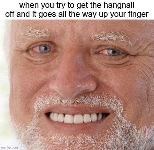 free Budapestlangd | when you try to get the hangnail off and it goes all the way up your finger | image tagged in hide the pain harold | made w/ Imgflip meme maker