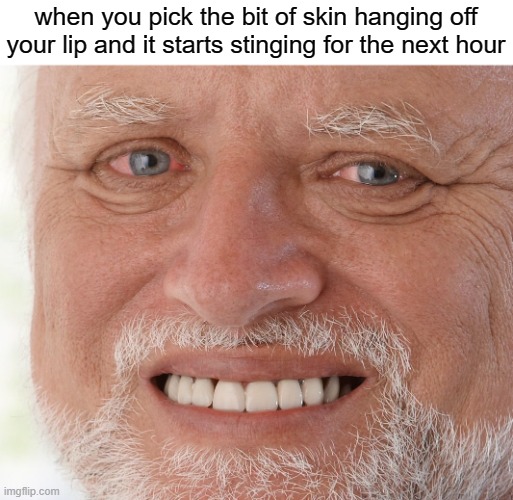 free epic Budapestlangd | when you pick the bit of skin hanging off your lip and it starts stinging for the next hour | image tagged in hide the pain harold | made w/ Imgflip meme maker