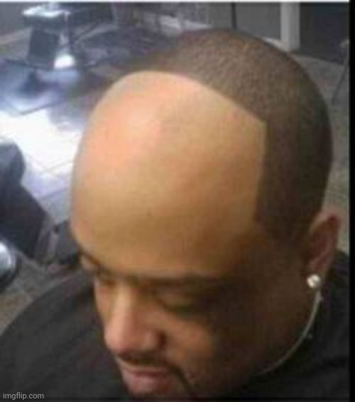 Hairline Pushback | image tagged in hairline pushback | made w/ Imgflip meme maker