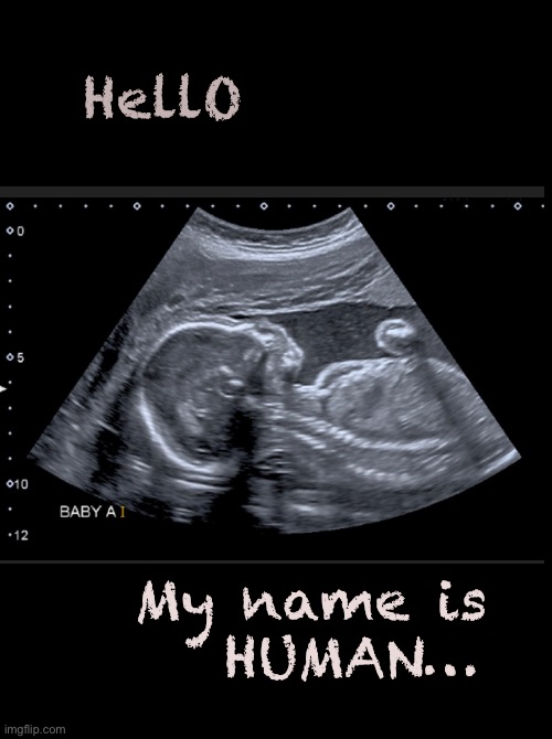 Of course!   What else would it be? | HellO; My name is
   HUMAN… | image tagged in memes,highly suspect,baby baby baby,xcept to lefties,effin progressives fjb voters kissmyass | made w/ Imgflip meme maker