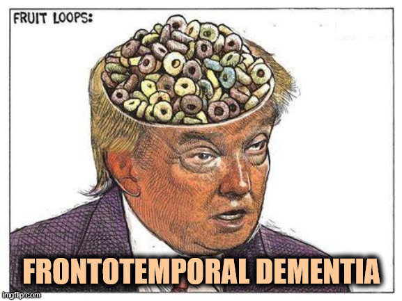 Repeat after me. Frontotemporal dementia. Frontotemporal dementia. | FRONTOTEMPORAL DEMENTIA | image tagged in trump frontotemporal dementia nuts fruit loops crazy,trump,frontotemporal dementia,senile,crazy,fruit loops | made w/ Imgflip meme maker