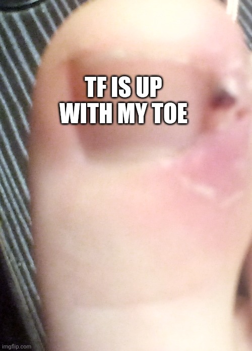 Ingrown | TF IS UP WITH MY TOE | made w/ Imgflip meme maker