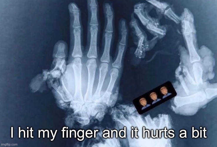 I hit my finger and it hurts a bit | made w/ Imgflip meme maker