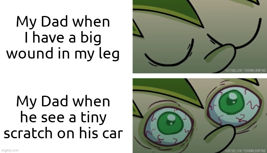 Dad's priority; Car < Child | My Dad when I have a big wound in my leg; My Dad when he see a tiny scratch on his car | image tagged in memes,dad,hurt,scratch,car | made w/ Imgflip meme maker