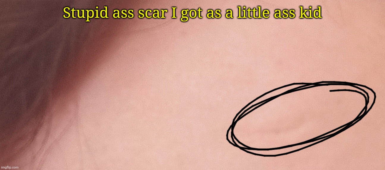Stupid ass scar I got as a little ass kid | made w/ Imgflip meme maker