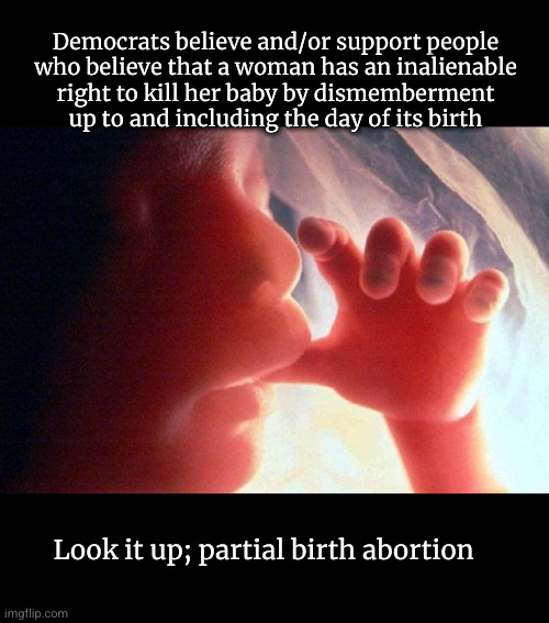 Democrats support partial birth abortion | Democrats believe and/or support people
who believe that a woman has an inalienable
right to kill her baby by dismemberment
up to and including the day of its birth; Look it up; partial birth abortion | image tagged in abortion,partial birth abortion,progressive democrats | made w/ Imgflip meme maker
