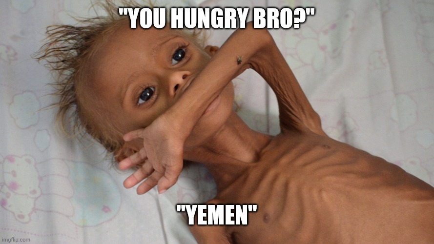 hungry yemen kid | "YOU HUNGRY BRO?" "YEMEN" | image tagged in hungry yemen kid | made w/ Imgflip meme maker