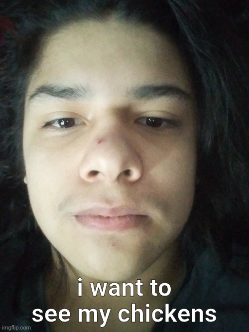 ignore the stupid-ass pimple on my nose | i want to see my chickens | made w/ Imgflip meme maker