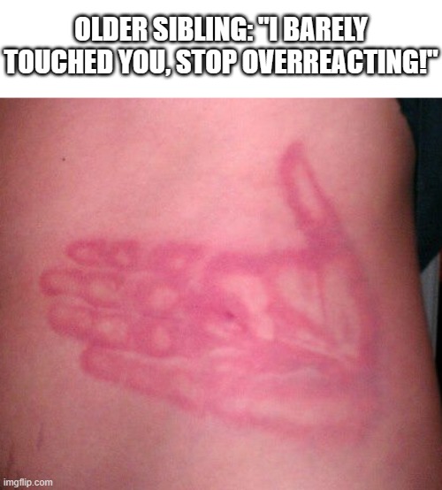 OLDER SIBLING: "I BARELY TOUCHED YOU, STOP OVERREACTING!" | image tagged in older sibling,slap,ouch | made w/ Imgflip meme maker