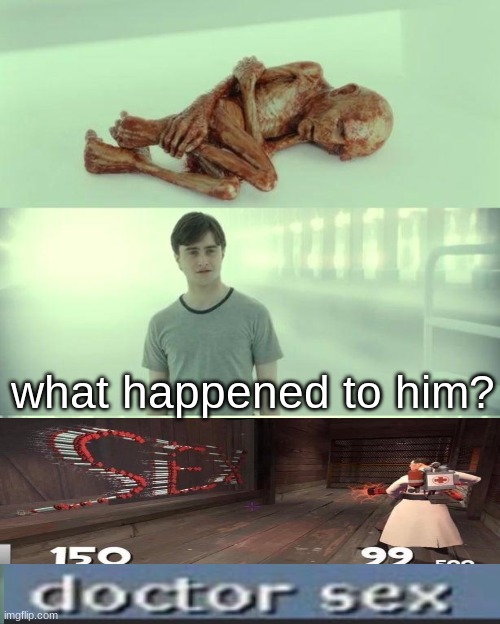 Dead Baby Voldemort / What Happened To Him | what happened to him? | image tagged in dead baby voldemort / what happened to him | made w/ Imgflip meme maker