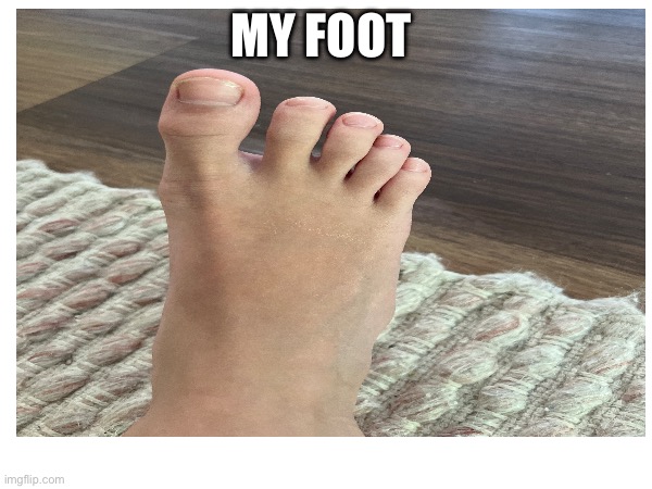 Foot reveal | MY FOOT | image tagged in memes,reveal,lol so funny | made w/ Imgflip meme maker