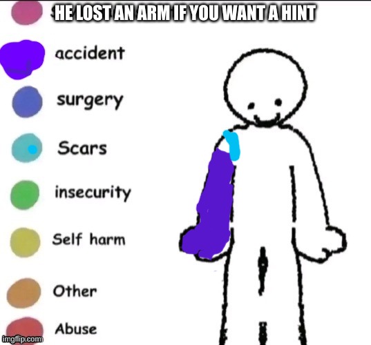 Who is it? | HE LOST AN ARM IF YOU WANT A HINT | image tagged in pain chart | made w/ Imgflip meme maker