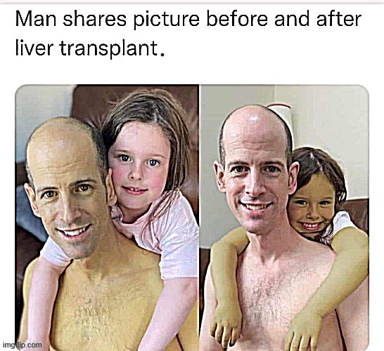 Choose life ! | image tagged in transplant | made w/ Imgflip meme maker