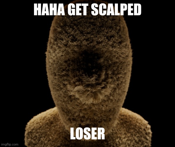 The scalpening, truly a scalp moment if all time | HAHA GET SCALPED; LOSER | image tagged in carpet head | made w/ Imgflip meme maker