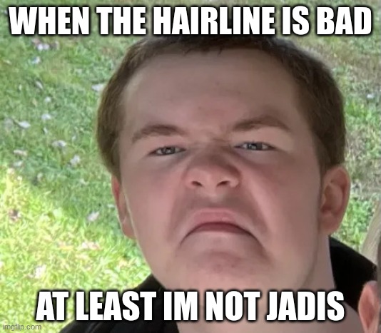 Space Geek | WHEN THE HAIRLINE IS BAD; AT LEAST IM NOT JADIS | image tagged in space geek | made w/ Imgflip meme maker
