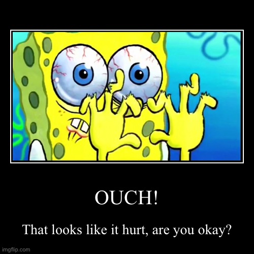 I’m bored, so I’m meming V1 | OUCH! | That looks like it hurt, are you okay? | image tagged in demotivationals | made w/ Imgflip demotivational maker