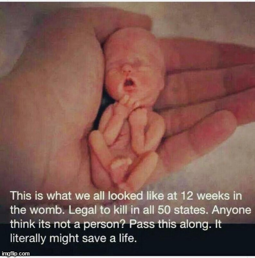 It's life... It's human...  no matter what they say | image tagged in abortion is murder | made w/ Imgflip meme maker