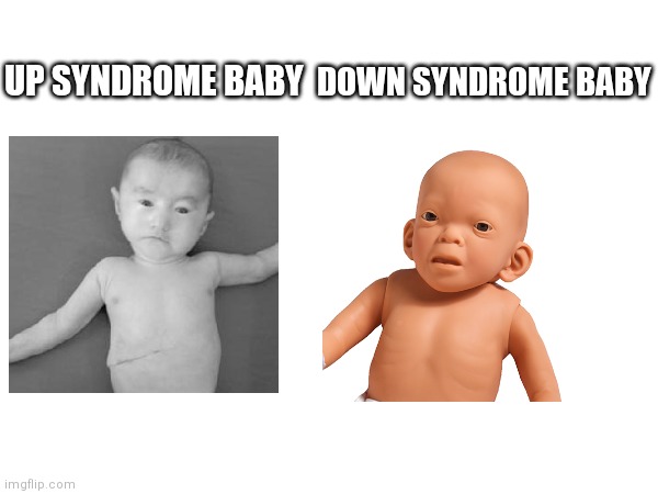 Babies with syndromes. Cute and creepy | DOWN SYNDROME BABY; UP SYNDROME BABY | image tagged in memes,cute,creepy,baby | made w/ Imgflip meme maker