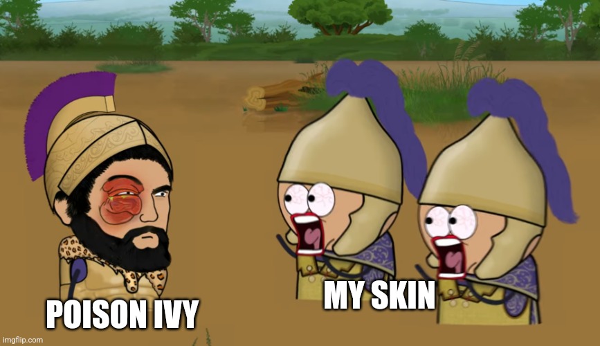 Very itchy | POISON IVY; MY SKIN | image tagged in second punic war | made w/ Imgflip meme maker