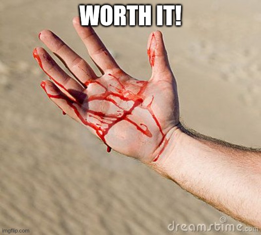 Bloody Hand | WORTH IT! | image tagged in bloody hand | made w/ Imgflip meme maker
