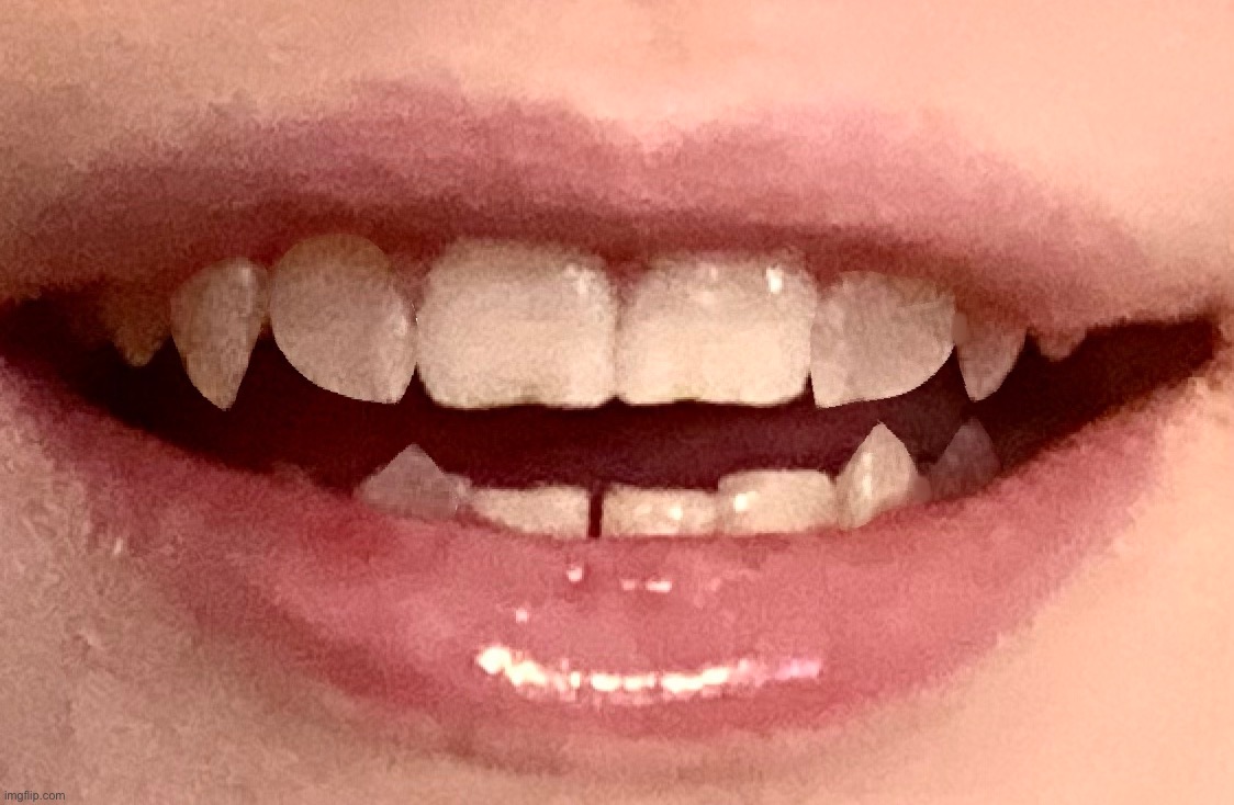 Teeth reveal | made w/ Imgflip meme maker