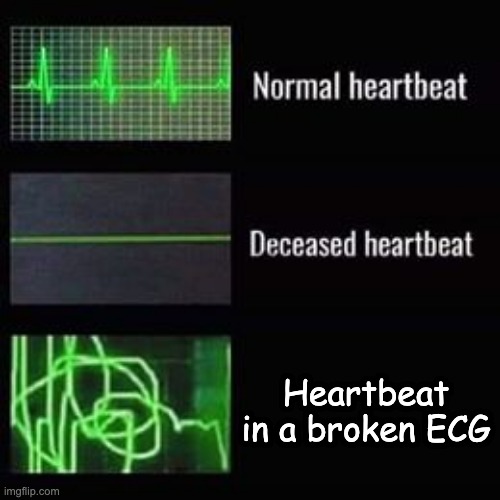 ECG | Heartbeat in a broken ECG | image tagged in heartbeat rate | made w/ Imgflip meme maker