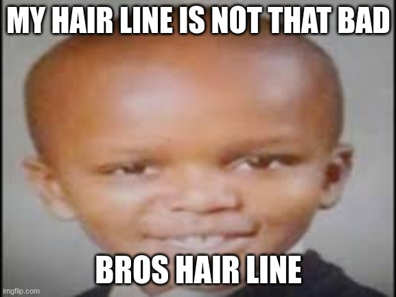 big head | MY HAIR LINE IS NOT THAT BAD; BROS HAIR LINE | image tagged in big head | made w/ Imgflip meme maker