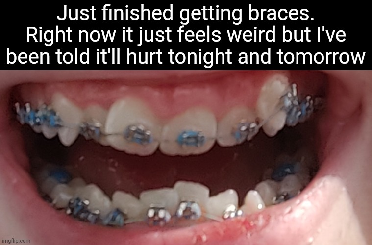 Teeth reveal | Just finished getting braces.
Right now it just feels weird but I've been told it'll hurt tonight and tomorrow | made w/ Imgflip meme maker