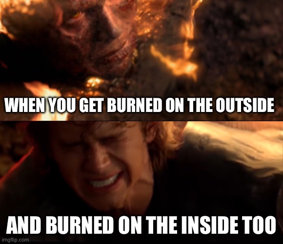 Burn | WHEN YOU GET BURNED ON THE OUTSIDE; AND BURNED ON THE INSIDE TOO | image tagged in anakin burns,aaaaaaaaaaaaaaaaaaaaaaaaaaa | made w/ Imgflip meme maker