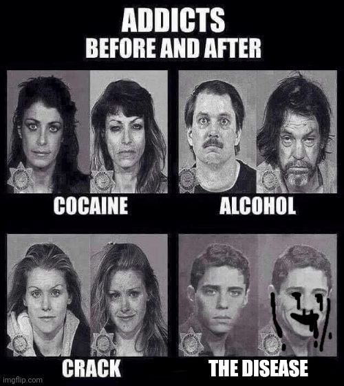 Addicts before and after | THE DISEASE | image tagged in addicts before and after | made w/ Imgflip meme maker