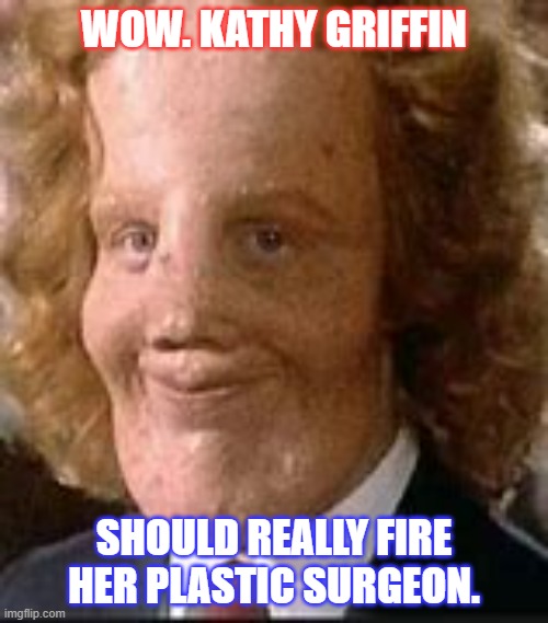 Poor Kathy | WOW. KATHY GRIFFIN; SHOULD REALLY FIRE HER PLASTIC SURGEON. | image tagged in funny | made w/ Imgflip meme maker