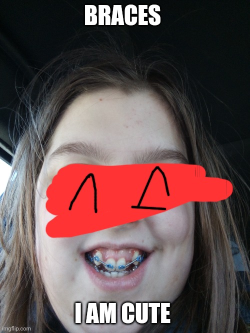 I have braces now | BRACES; I AM CUTE | made w/ Imgflip meme maker