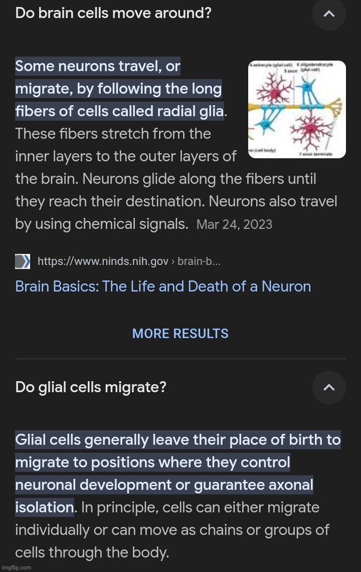 I was today years old when I found out your brain and glial cells walk. | made w/ Imgflip meme maker